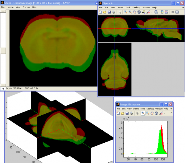 Visualisation d'images 3D sous Matlab