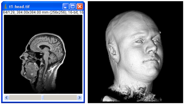 Visualisation d'une image 3D par coupe, ou par isosurface